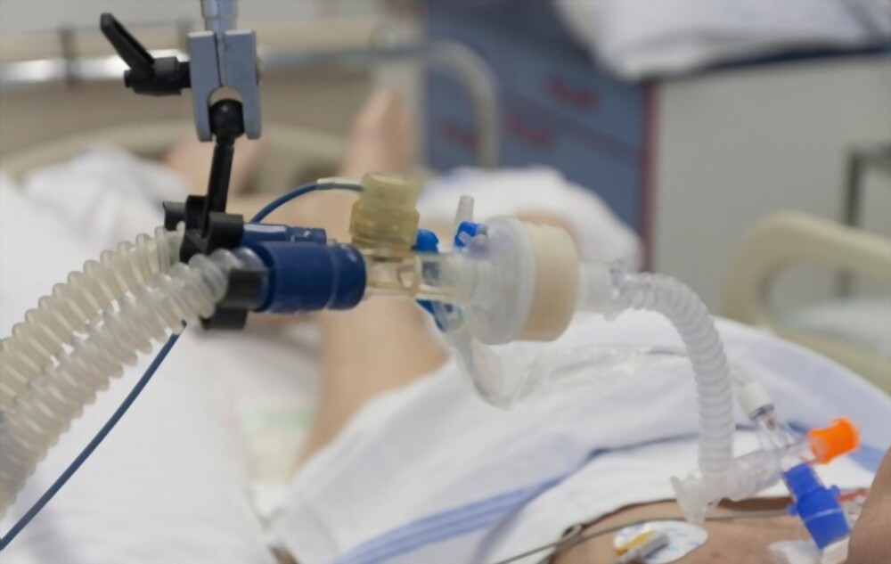 Humidificaci n Pasiva En Ventilaci n Mec nica CAMPUS KINESICO Humidificaci n Pasiva En Ventilaci n Mec nica CAMPUS KINESICO