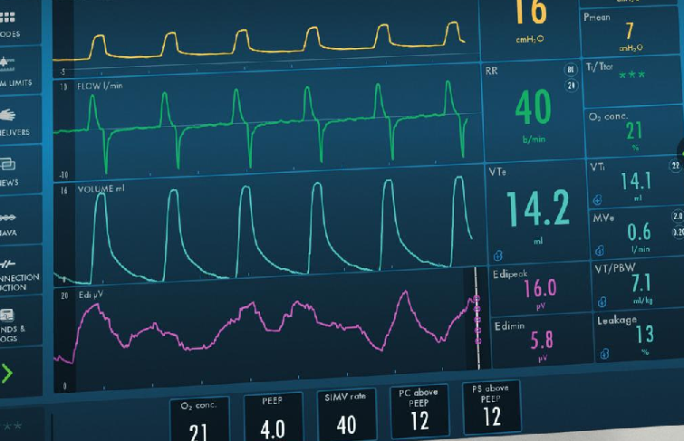 Ventilación Mecánica: Lo Básico Que Debes Saber- CAMPUS KINESICO